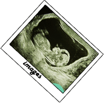 Baby's first picture